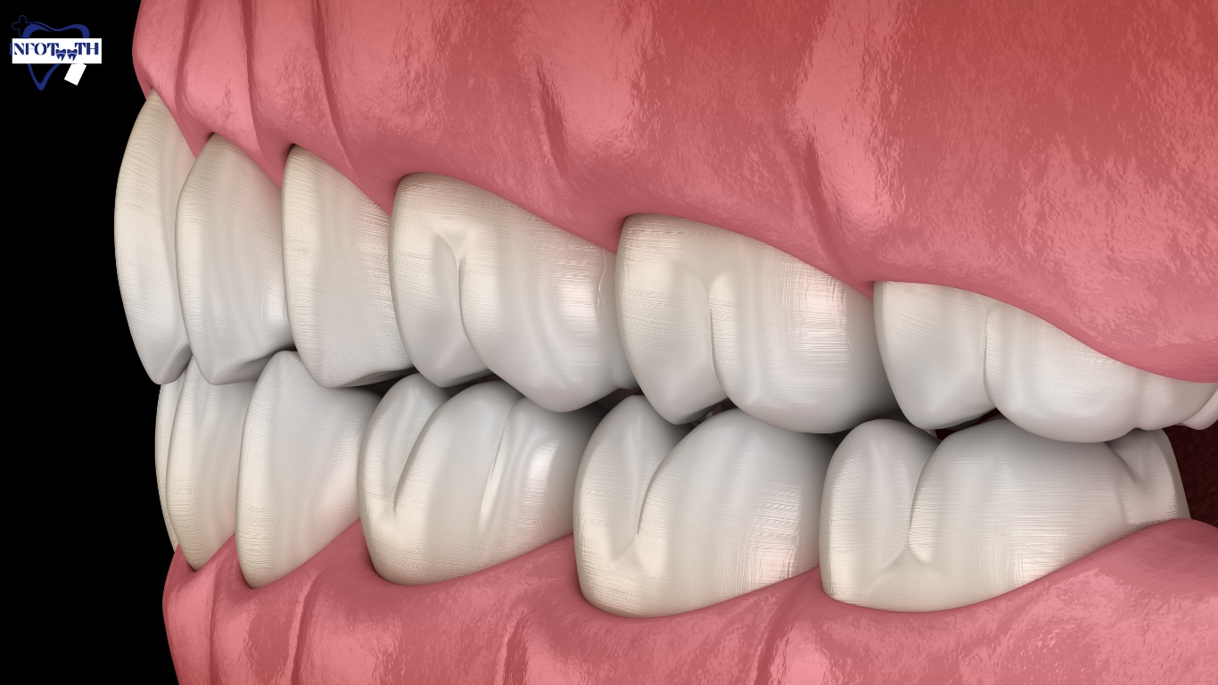 Bicuspid Teeth Functions Types And Tips Infoteeth