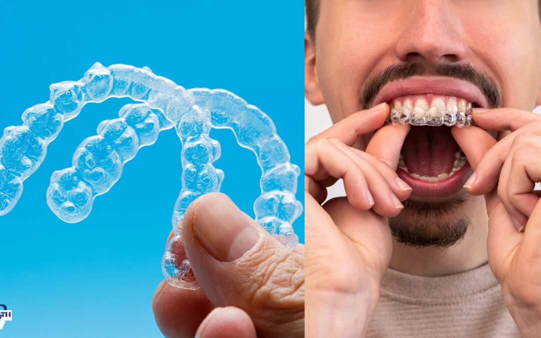 Can Invisalign fix teeth that stick out