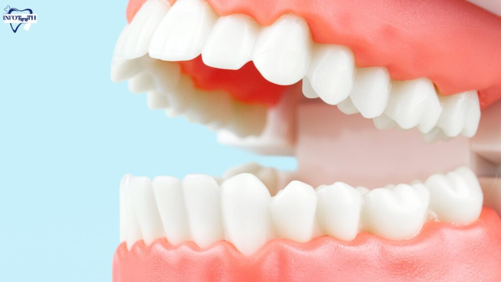 How To Fix Flared Teeth? - Infoteeth